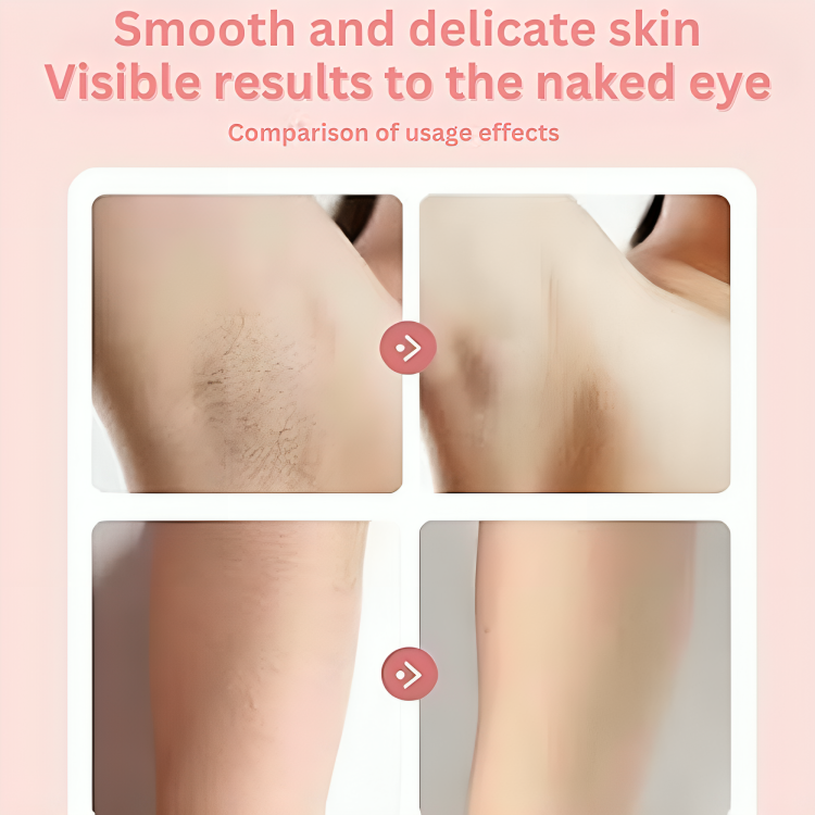 SilkEase Pro - 50% OFF
