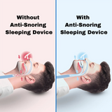 Anti-snoring Sleeping Aid